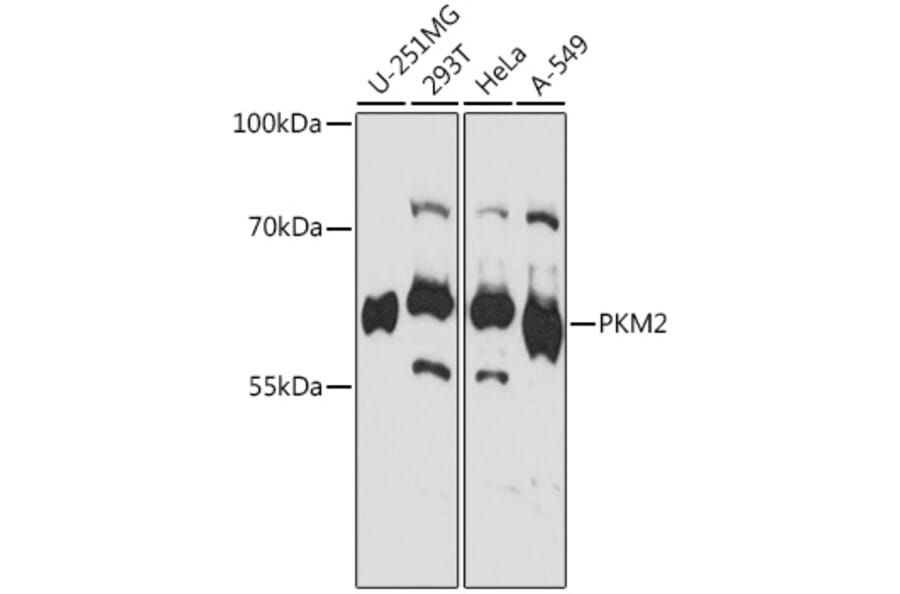 Western Blot - Anti-PKM Antibody (A92676) - Antibodies.com