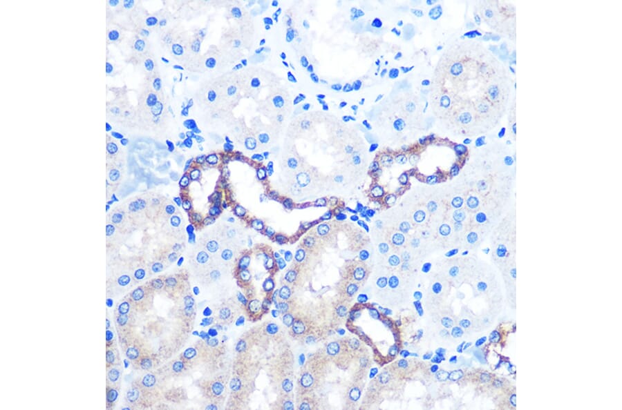 Immunohistochemistry - Anti-PKM Antibody (A92676) - Antibodies.com