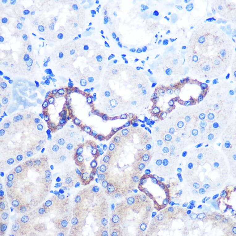Immunohistochemistry - Anti-PKM Antibody (A92676) - Antibodies.com