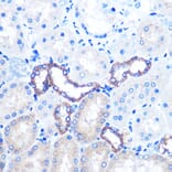 Immunohistochemistry - Anti-PKM Antibody (A92676) - Antibodies.com