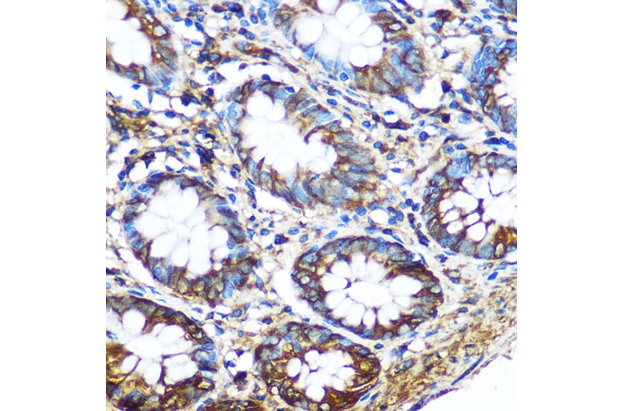 Immunohistochemistry - Anti-PKM Antibody (A92676) - Antibodies.com