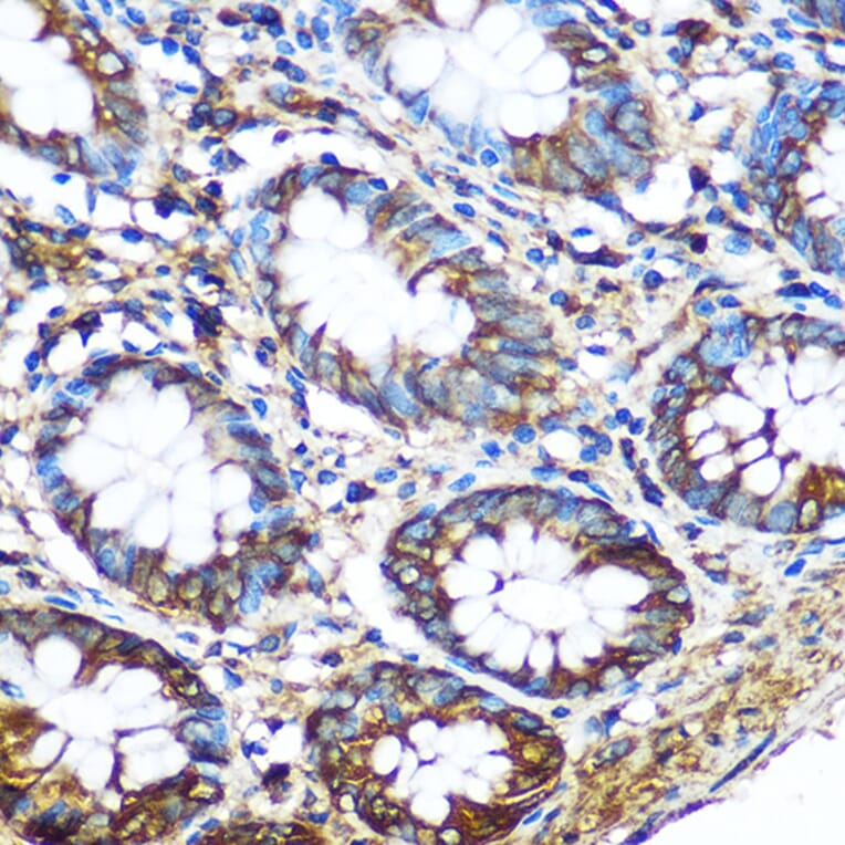 Immunohistochemistry - Anti-PKM Antibody (A92676) - Antibodies.com