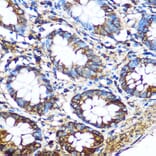 Immunohistochemistry - Anti-PKM Antibody (A92676) - Antibodies.com