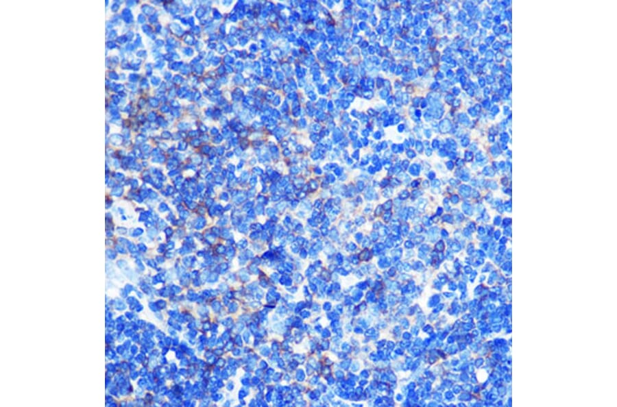 Immunohistochemistry - Anti-PKM Antibody (A92676) - Antibodies.com