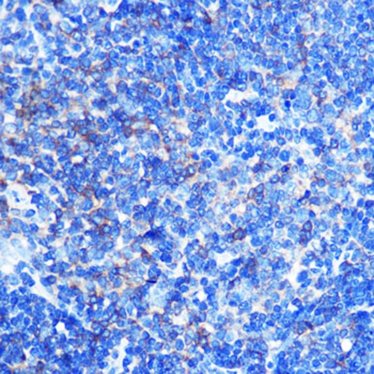 Immunohistochemistry - Anti-PKM Antibody (A92676) - Antibodies.com