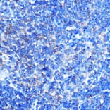 Immunohistochemistry - Anti-PKM Antibody (A92676) - Antibodies.com