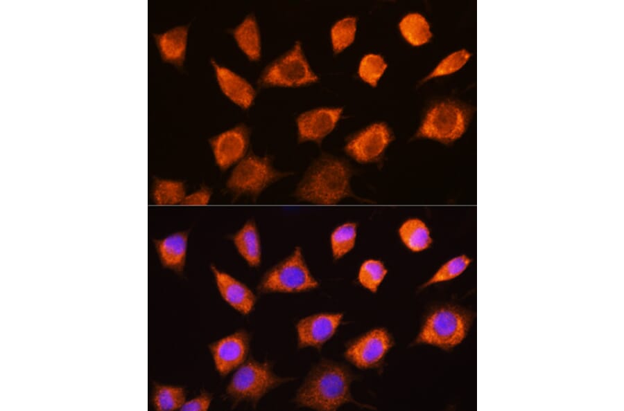 Immunofluorescence - Anti-PKM Antibody (A92676) - Antibodies.com