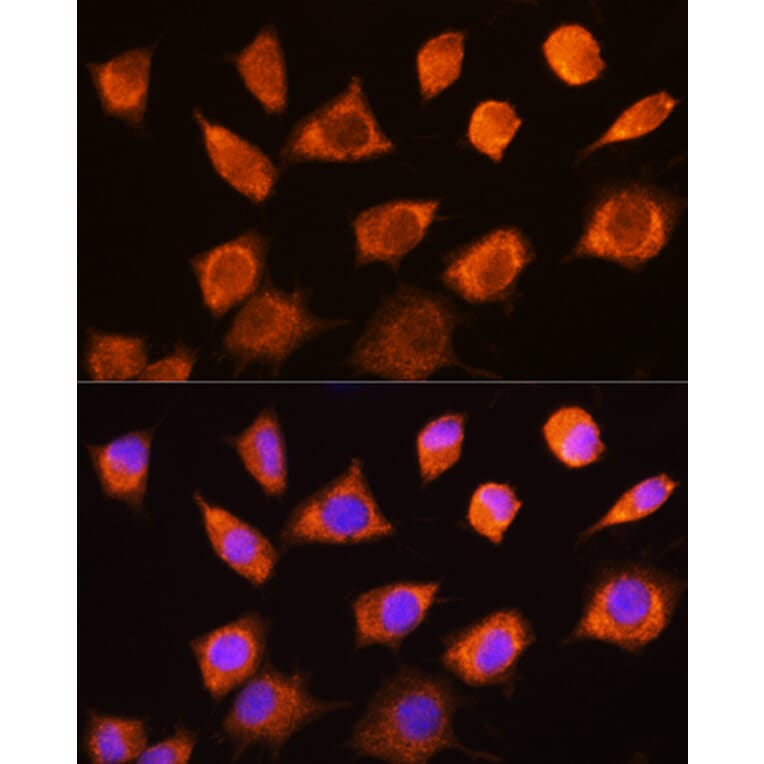 Immunofluorescence - Anti-PKM Antibody (A92676) - Antibodies.com
