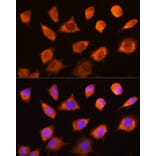 Immunofluorescence - Anti-PKM Antibody (A92676) - Antibodies.com