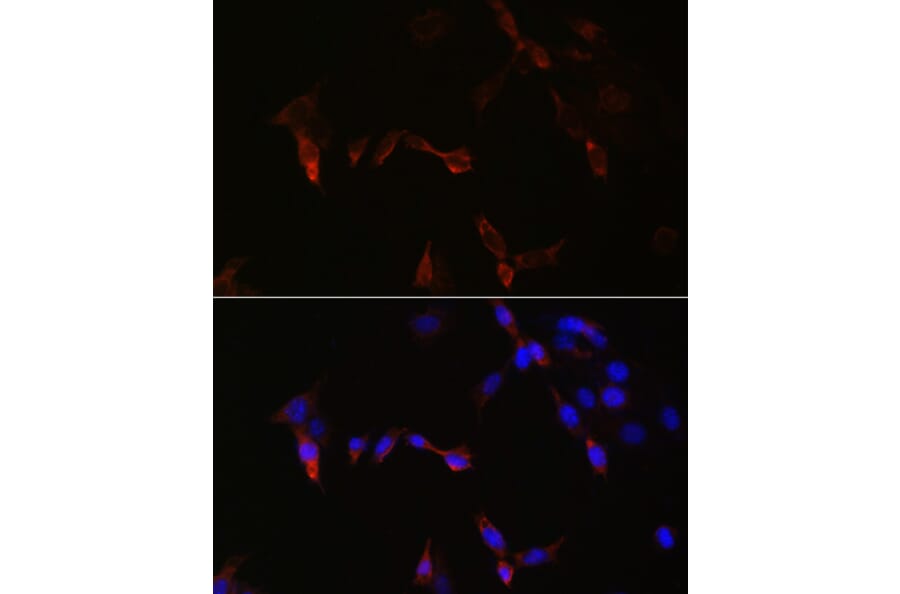 Immunofluorescence - Anti-PLA2G5 Antibody (A16711) - Antibodies.com