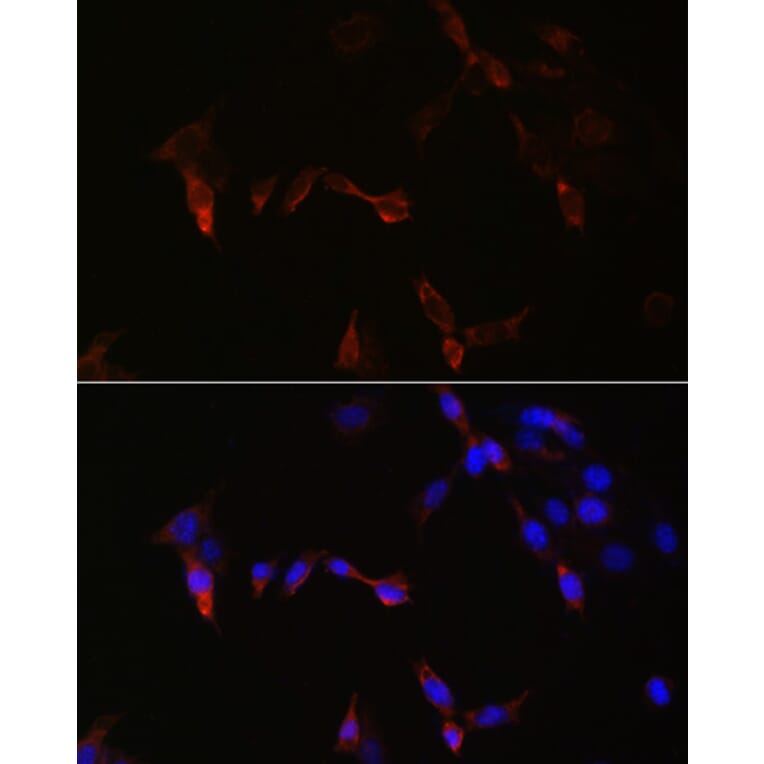 Immunofluorescence - Anti-PLA2G5 Antibody (A16711) - Antibodies.com