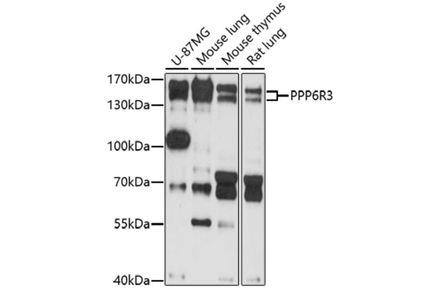 Western Blot - Anti-SAPS3 Antibody (A92682) - Antibodies.com