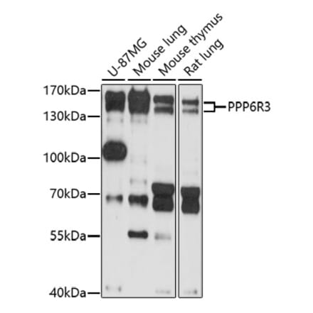 Western Blot - Anti-SAPS3 Antibody (A92682) - Antibodies.com