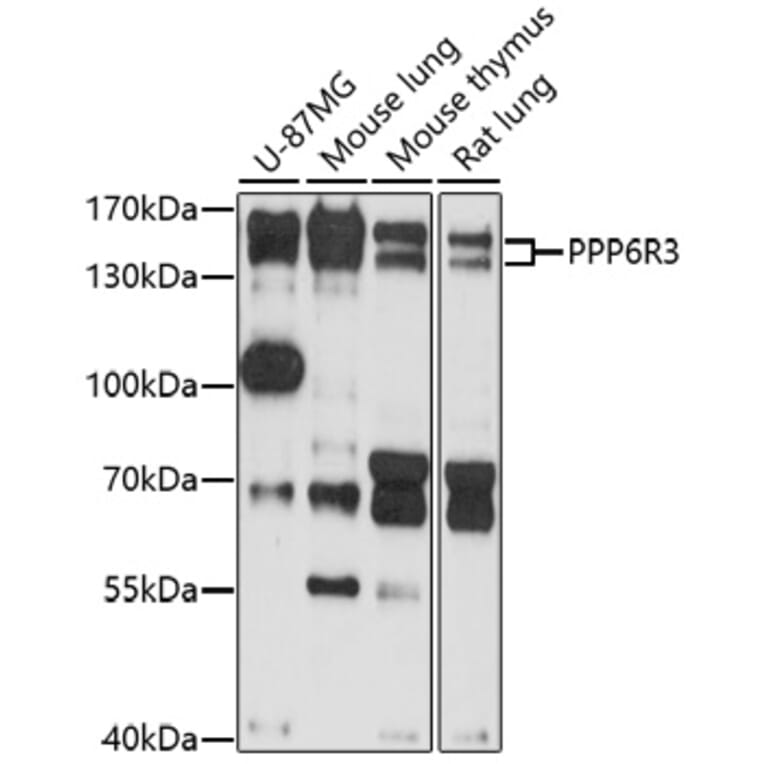 Western Blot - Anti-SAPS3 Antibody (A92682) - Antibodies.com