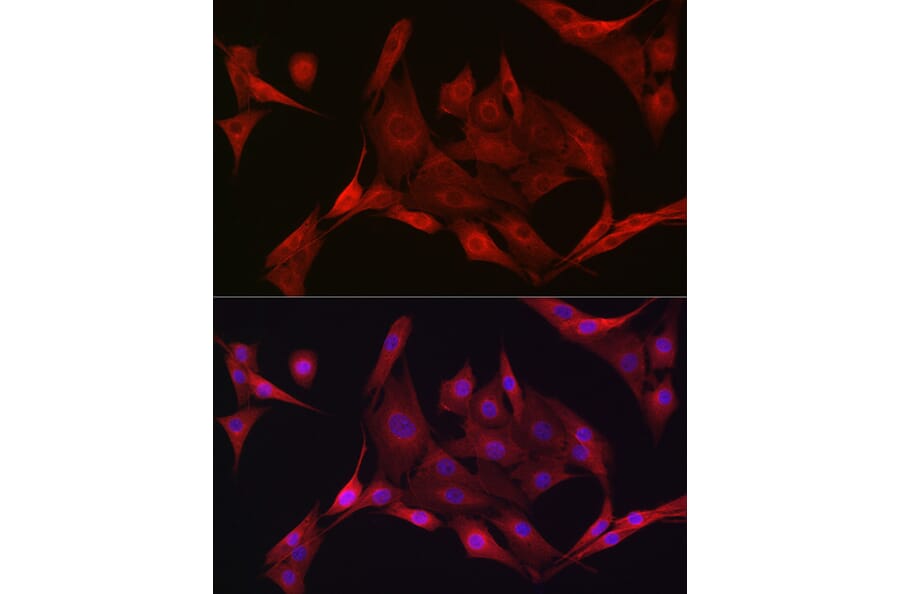 Immunofluorescence - Anti-AMPK alpha 1 +AMPK alpha 2 Antibody (A92683) - Antibodies.com