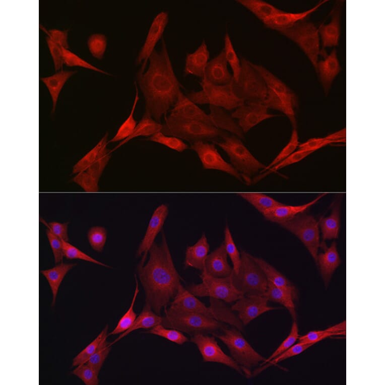 Immunofluorescence - Anti-AMPK alpha 1 +AMPK alpha 2 Antibody (A92683) - Antibodies.com