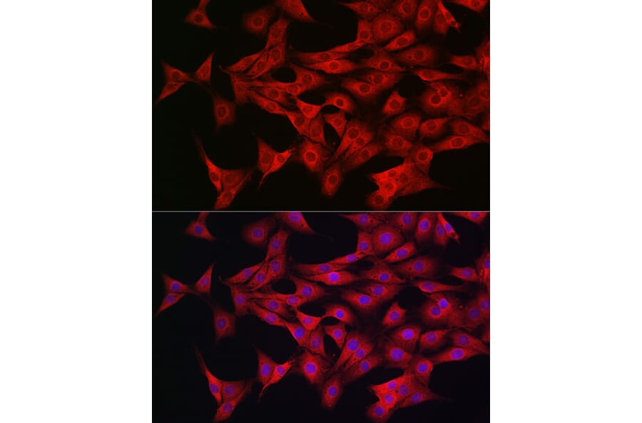 Immunofluorescence - Anti-AMPK alpha 1 +AMPK alpha 2 Antibody (A92683) - Antibodies.com