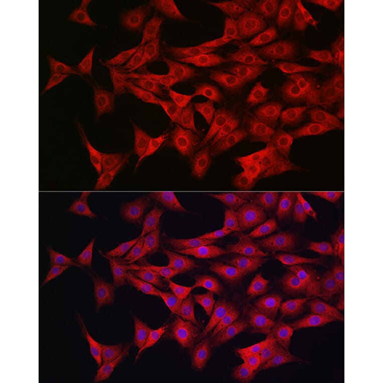 Immunofluorescence - Anti-AMPK alpha 1 +AMPK alpha 2 Antibody (A92683) - Antibodies.com