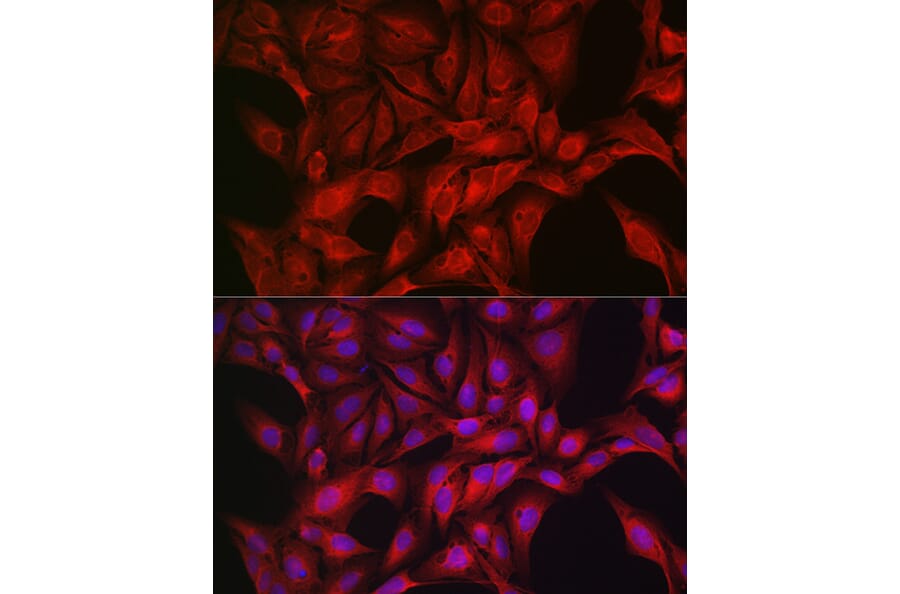 Immunofluorescence - Anti-AMPK alpha 1 +AMPK alpha 2 Antibody (A92683) - Antibodies.com