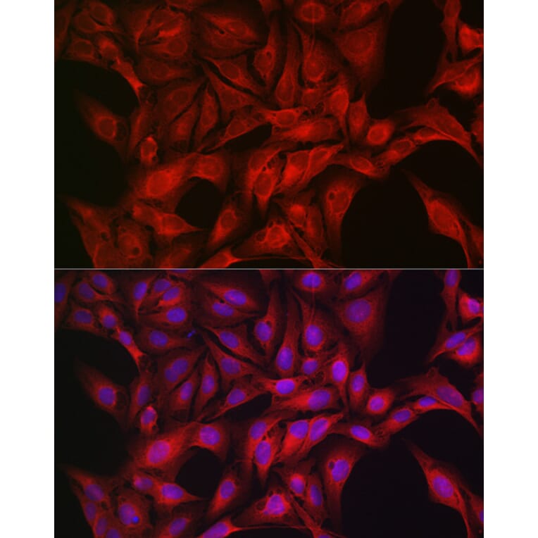 Immunofluorescence - Anti-AMPK alpha 1 +AMPK alpha 2 Antibody (A92683) - Antibodies.com