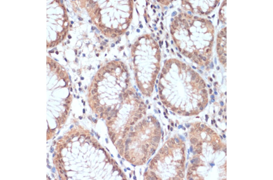 Immunohistochemistry - Anti-PRMT7 Antibody (A92684) - Antibodies.com