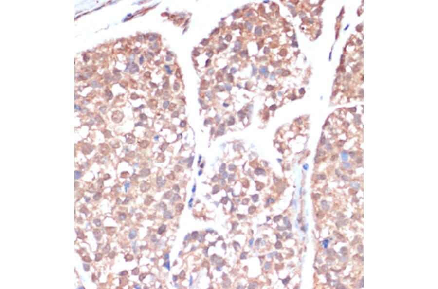 Immunohistochemistry - Anti-PRMT7 Antibody (A92684) - Antibodies.com