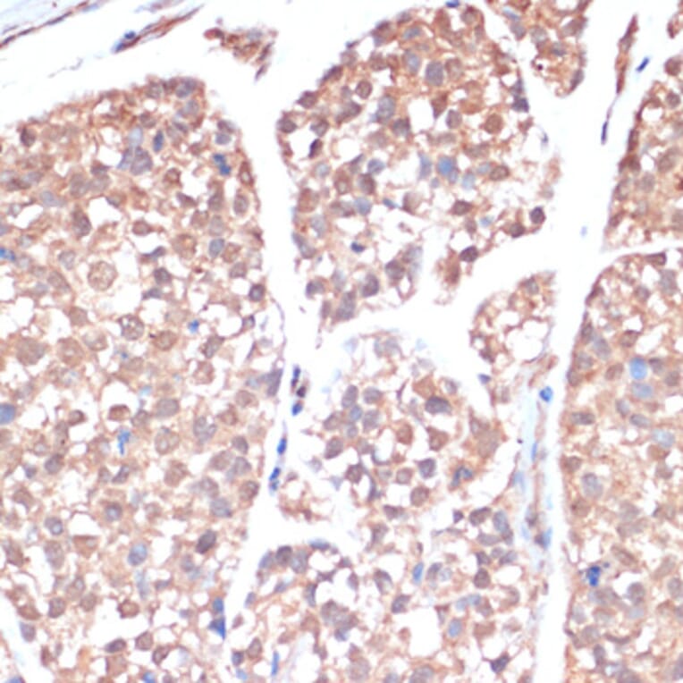 Immunohistochemistry - Anti-PRMT7 Antibody (A92684) - Antibodies.com