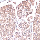 Immunohistochemistry - Anti-PRMT7 Antibody (A92684) - Antibodies.com