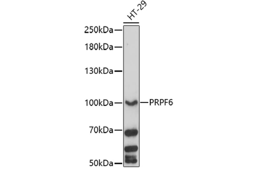 Western Blot - Anti-PRP6/ANT-1 Antibody (A92686) - Antibodies.com