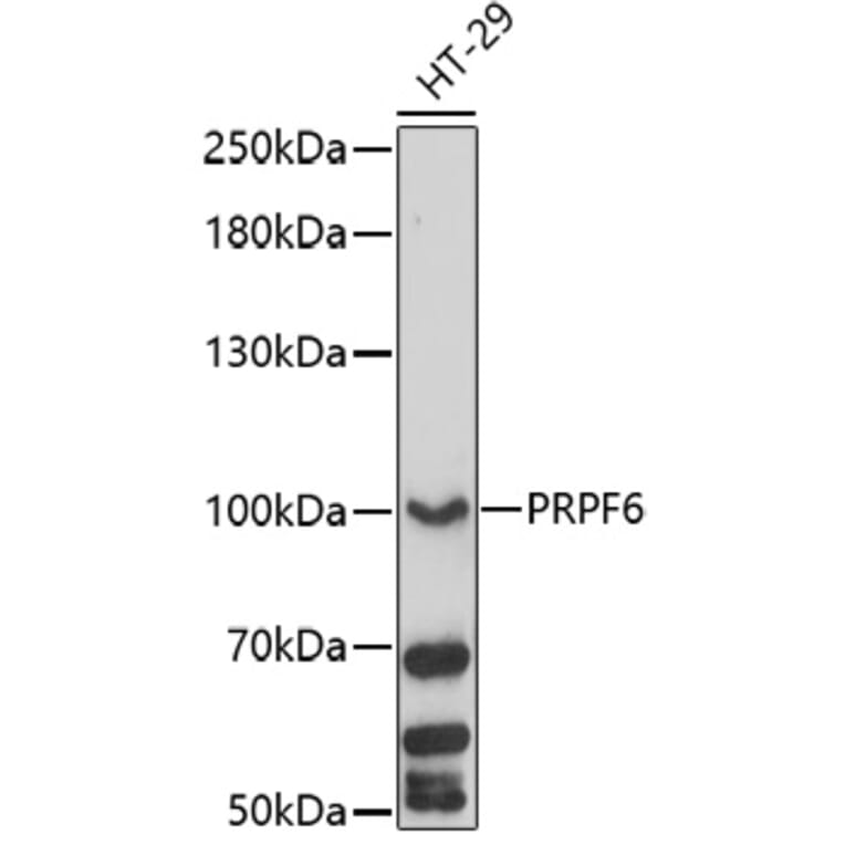 Western Blot - Anti-PRP6/ANT-1 Antibody (A92686) - Antibodies.com
