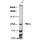 Western Blot - Anti-PRP6/ANT-1 Antibody (A92686) - Antibodies.com