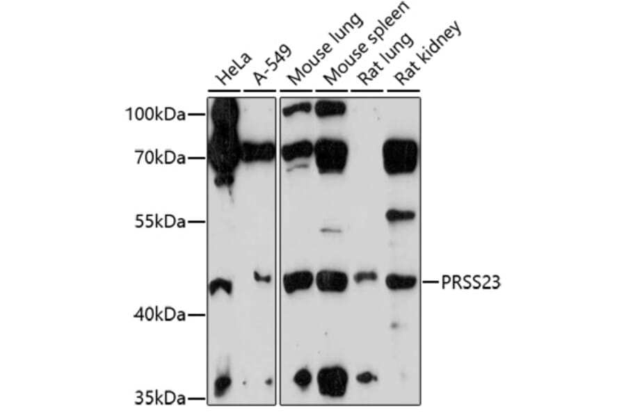 Western Blot - Anti-PRSS23 Antibody (A92687) - Antibodies.com