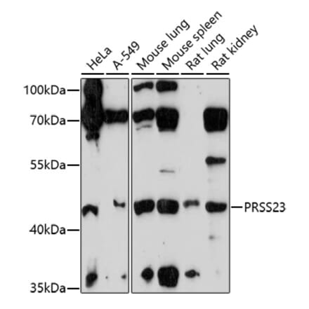 Western Blot - Anti-PRSS23 Antibody (A92687) - Antibodies.com