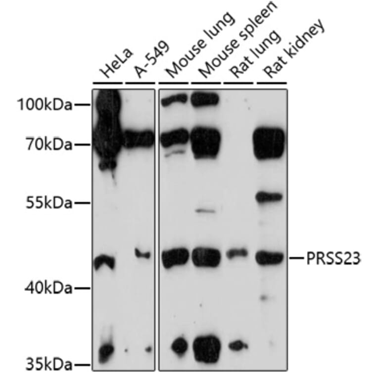 Western Blot - Anti-PRSS23 Antibody (A92687) - Antibodies.com