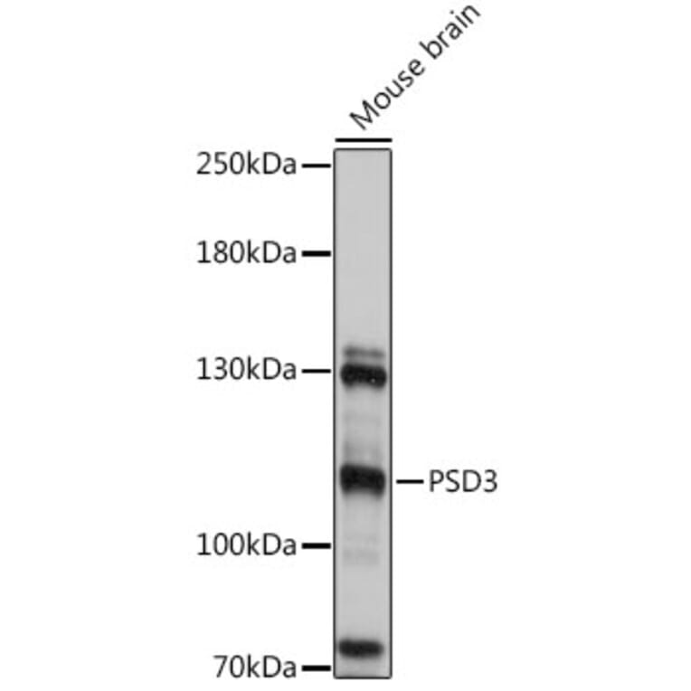 Western Blot - Anti-PSD3 Antibody (A92688) - Antibodies.com