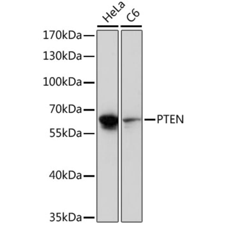 Western Blot - Anti-PTEN Antibody (A92689) - Antibodies.com