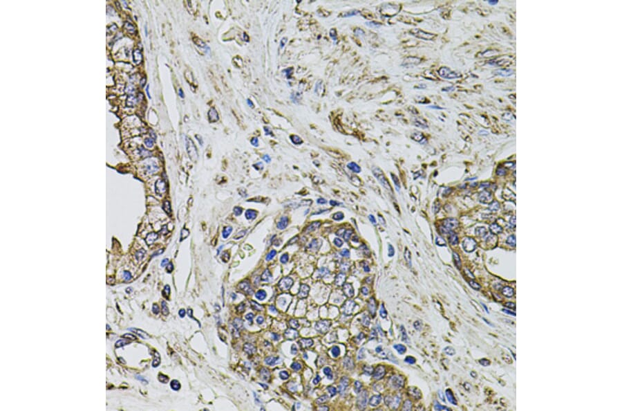Immunohistochemistry - Anti-PTHLH Antibody (A12492) - Antibodies.com