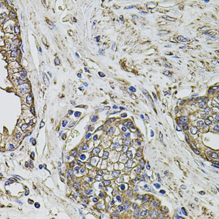 Immunohistochemistry - Anti-PTHLH Antibody (A12492) - Antibodies.com