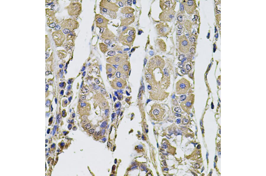 Immunohistochemistry - Anti-PTHLH Antibody (A12492) - Antibodies.com