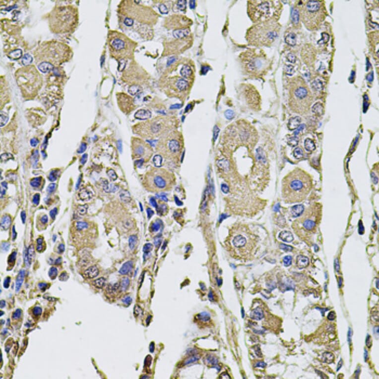Immunohistochemistry - Anti-PTHLH Antibody (A12492) - Antibodies.com