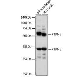 Western Blot - Anti-STEP / PTPN5 Antibody (A92692) - Antibodies.com