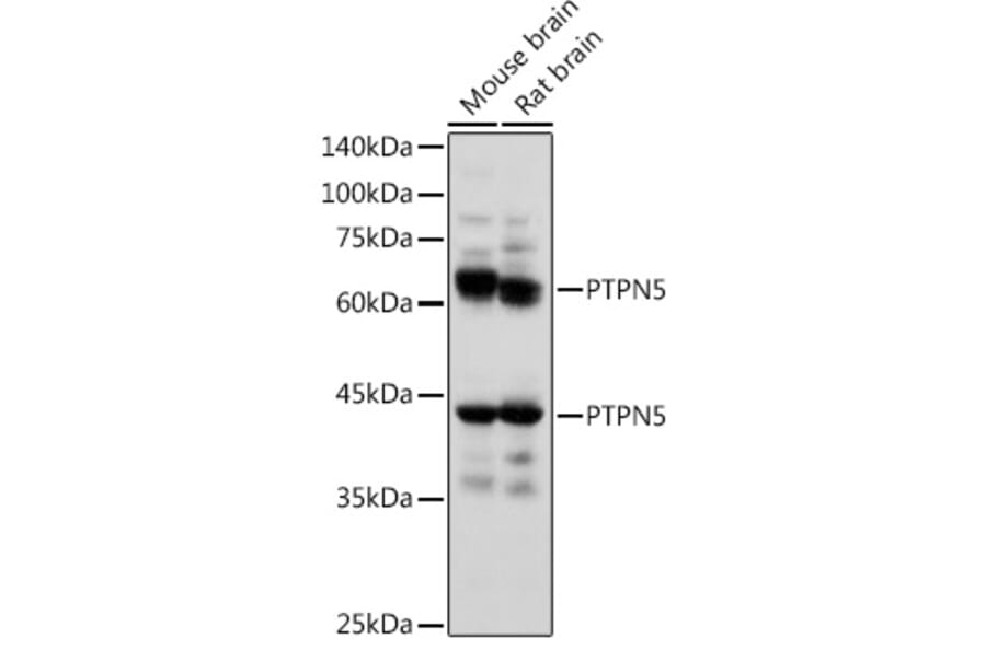 Western Blot - Anti-STEP/PTPN5 Antibody (A92692) - Antibodies.com