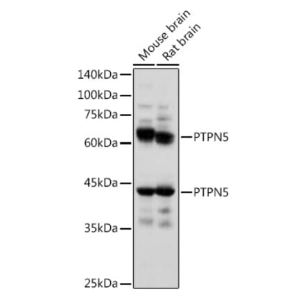 Western Blot - Anti-STEP / PTPN5 Antibody (A92692) - Antibodies.com