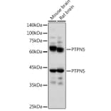 Western Blot - Anti-STEP/PTPN5 Antibody (A92692) - Antibodies.com