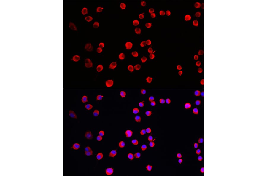 Immunofluorescence - Anti-STEP/PTPN5 Antibody (A92692) - Antibodies.com