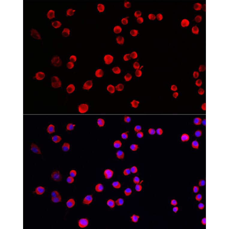 Immunofluorescence - Anti-STEP/PTPN5 Antibody (A92692) - Antibodies.com
