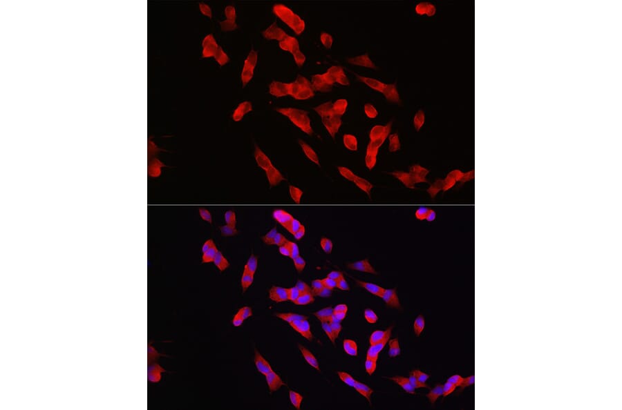 Immunofluorescence - Anti-STEP/PTPN5 Antibody (A92692) - Antibodies.com