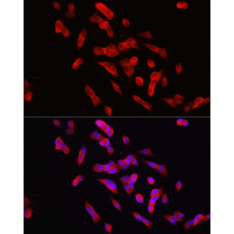 Immunofluorescence - Anti-STEP/PTPN5 Antibody (A92692) - Antibodies.com