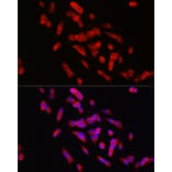 Immunofluorescence - Anti-STEP/PTPN5 Antibody (A92692) - Antibodies.com