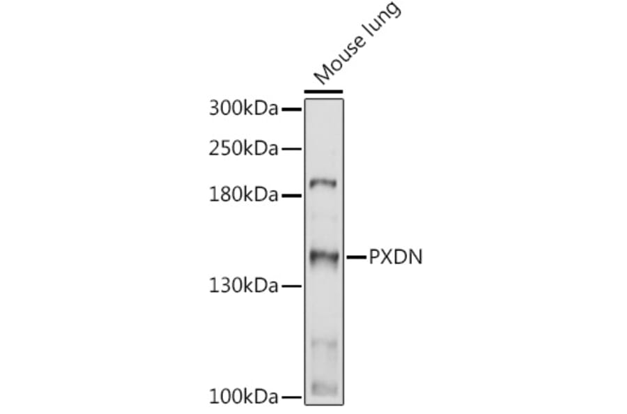 Western Blot - Anti-PXDN/VPO1 Antibody (A92694) - Antibodies.com